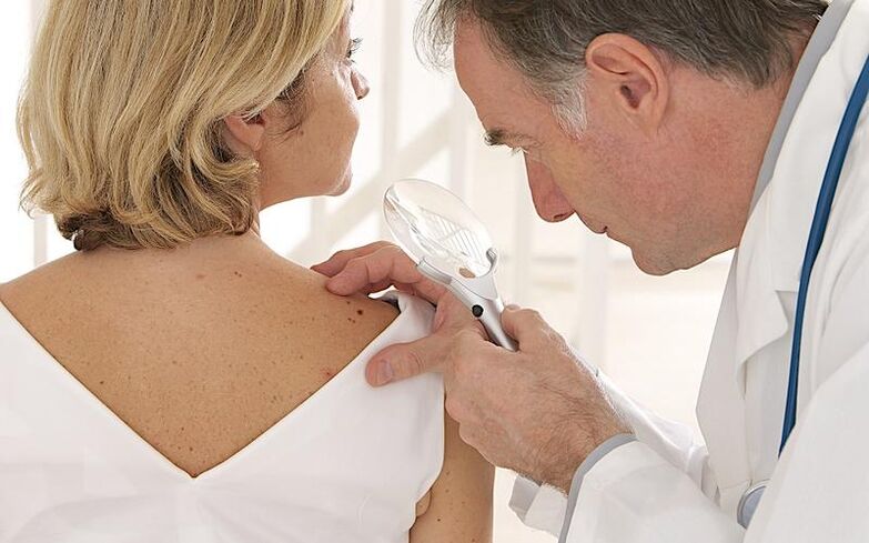 Woman with papilloma at the doctor's appointment before taking gel Removio